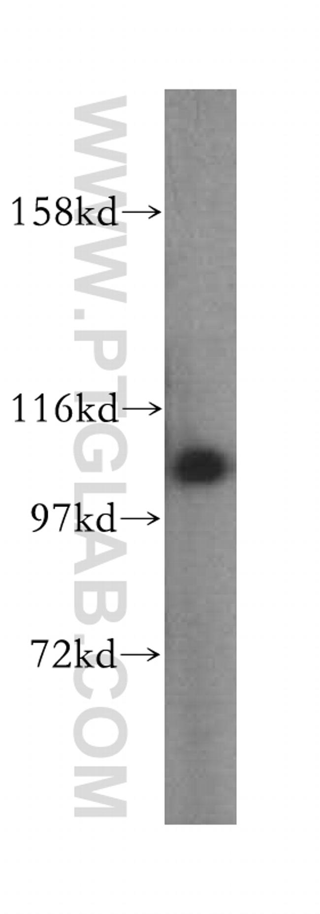 AlaRS Antibody in Western Blot (WB)