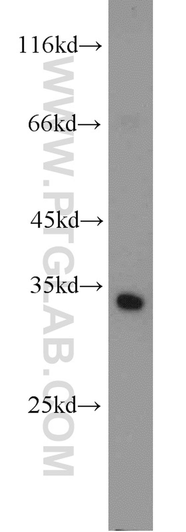 PDCL2 Antibody in Western Blot (WB)