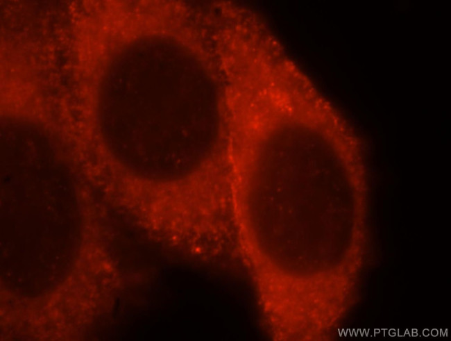 CD33 Antibody in Immunocytochemistry (ICC/IF)