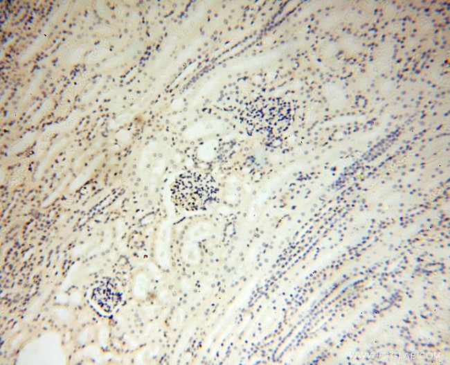 CD33 Antibody in Immunohistochemistry (Paraffin) (IHC (P))