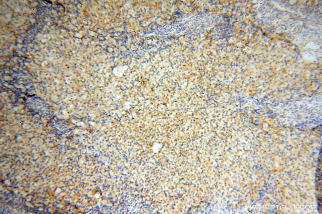 CD33 Antibody in Immunohistochemistry (Paraffin) (IHC (P))