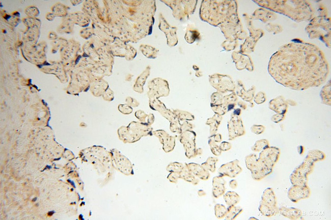 CD33 Antibody in Immunohistochemistry (Paraffin) (IHC (P))