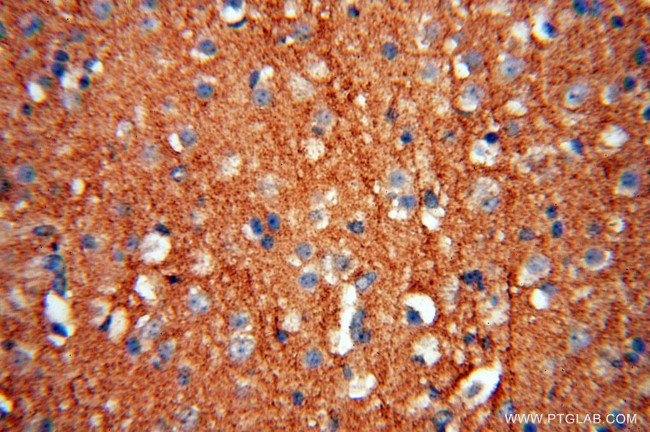 CD33 Antibody in Immunohistochemistry (Paraffin) (IHC (P))