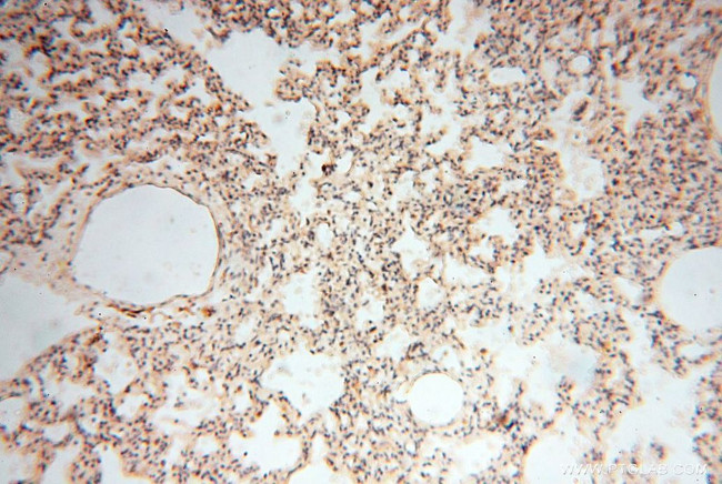 CD33 Antibody in Immunohistochemistry (Paraffin) (IHC (P))