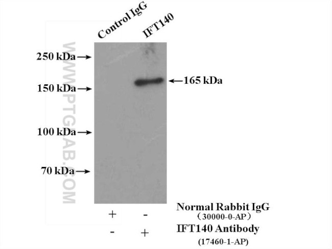 IFT140 Antibody in Immunoprecipitation (IP)