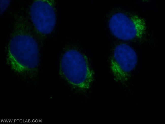 CLUAP1 Antibody in Immunocytochemistry (ICC/IF)