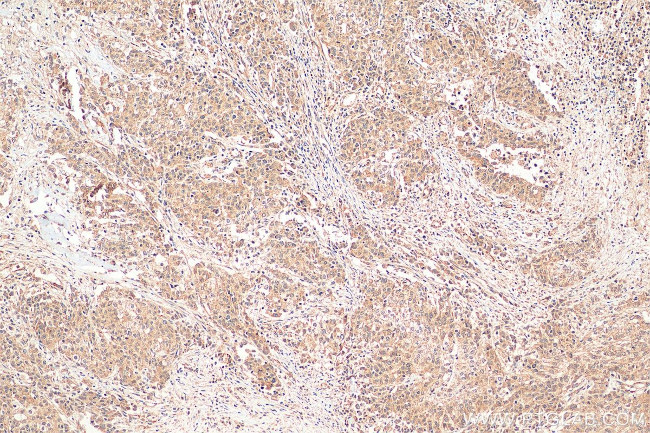 ANUBL1 Antibody in Immunohistochemistry (Paraffin) (IHC (P))