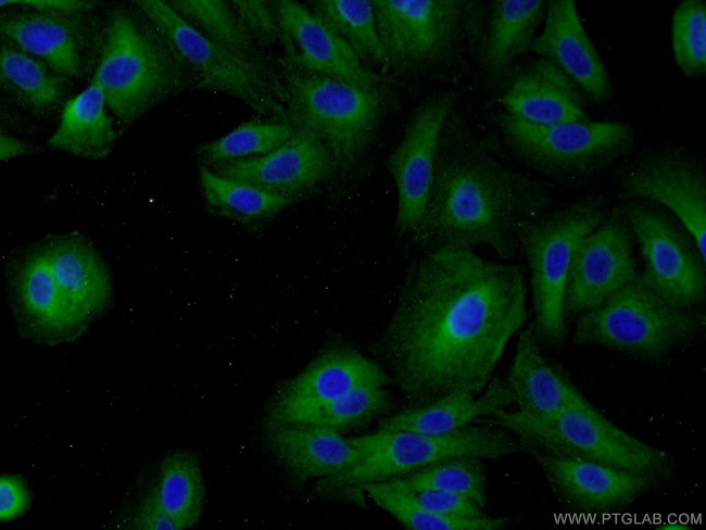 MAGEB18 Antibody in Immunocytochemistry (ICC/IF)