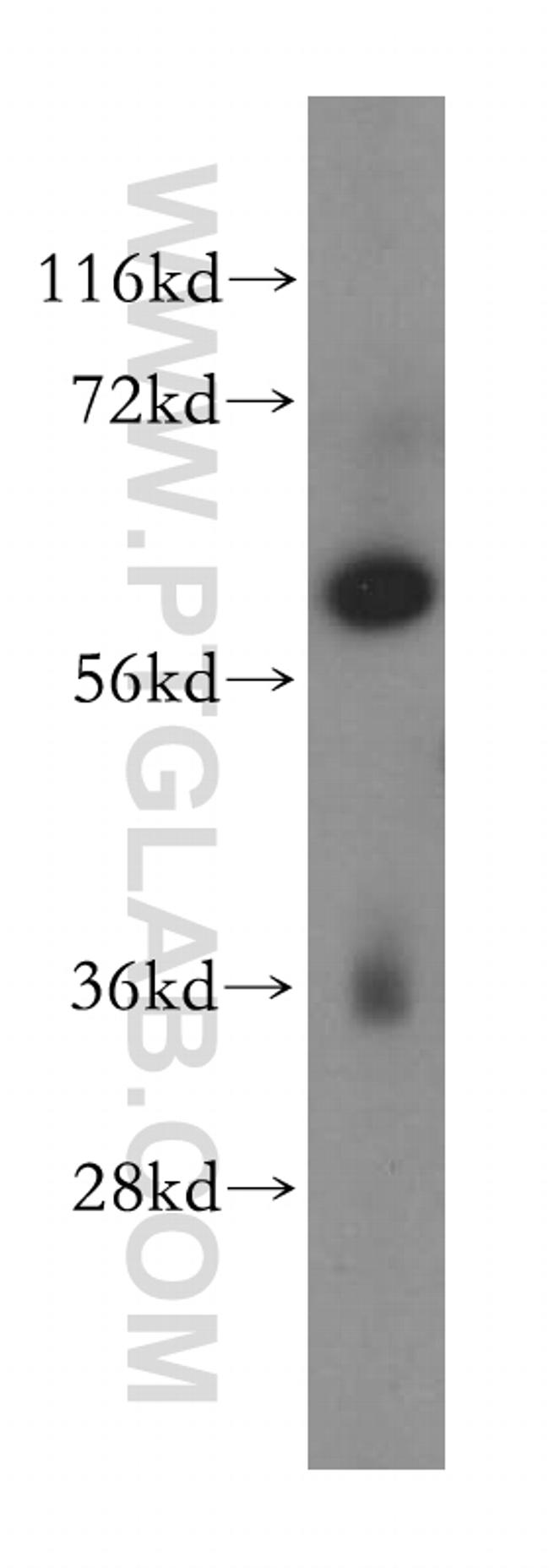 MAGEB18 Antibody in Western Blot (WB)