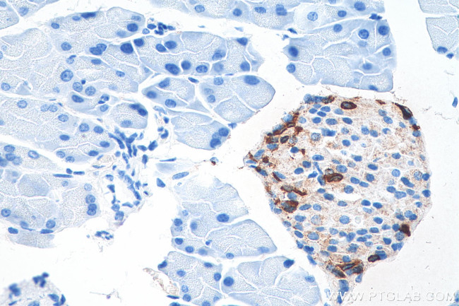 Somatostatin Antibody in Immunohistochemistry (Paraffin) (IHC (P))