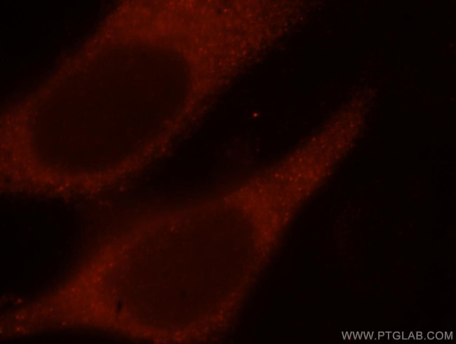 IFT52 Antibody in Immunocytochemistry (ICC/IF)