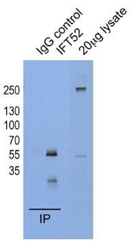 IFT52 Antibody in Immunoprecipitation (IP)