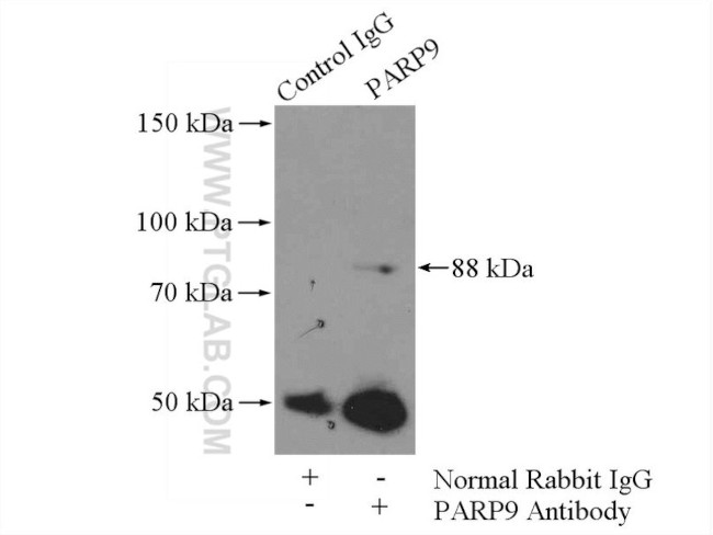 PARP9 Antibody in Immunoprecipitation (IP)