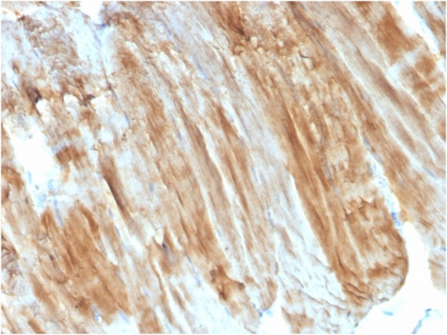 Dystrophin (DMD) Antibody in Immunohistochemistry (Paraffin) (IHC (P))