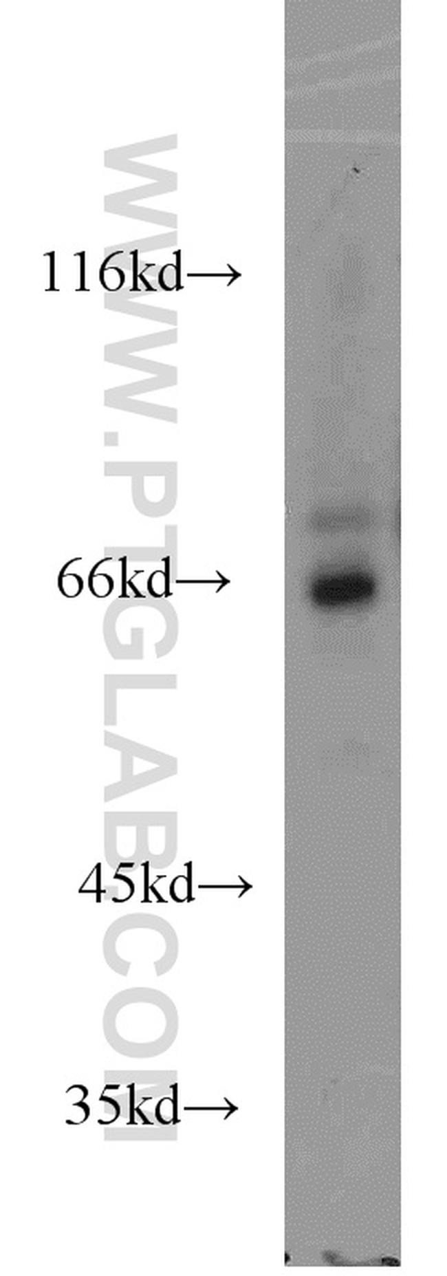 ADCK5 Antibody in Western Blot (WB)
