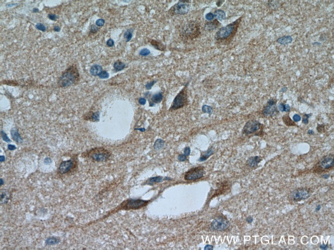 PYK2 Antibody in Immunohistochemistry (Paraffin) (IHC (P))