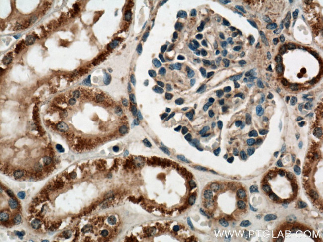 PYK2 Antibody in Immunohistochemistry (Paraffin) (IHC (P))