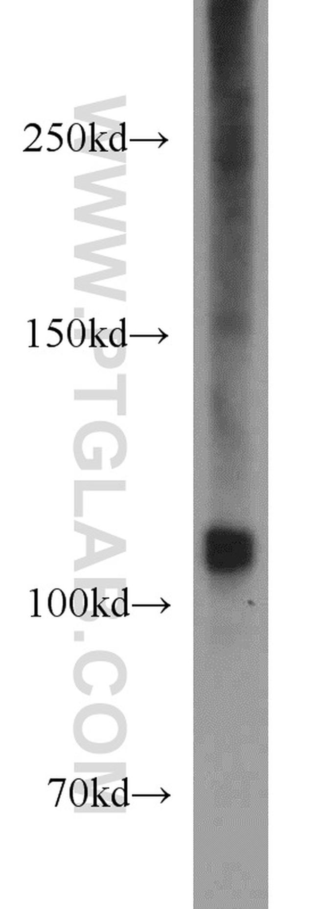 PYK2 Antibody in Western Blot (WB)