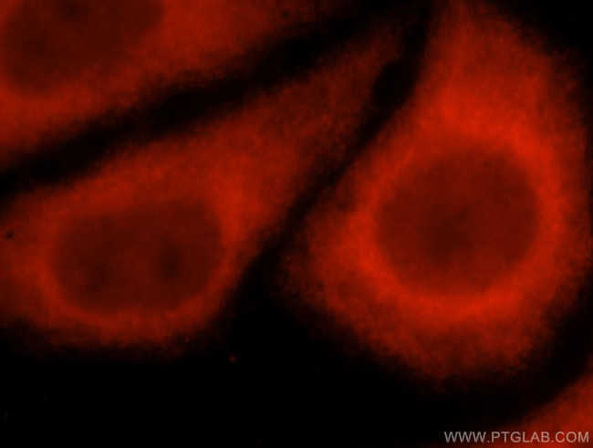 EXOC5 Antibody in Immunocytochemistry (ICC/IF)