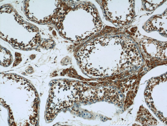 EXOC5 Antibody in Immunohistochemistry (Paraffin) (IHC (P))