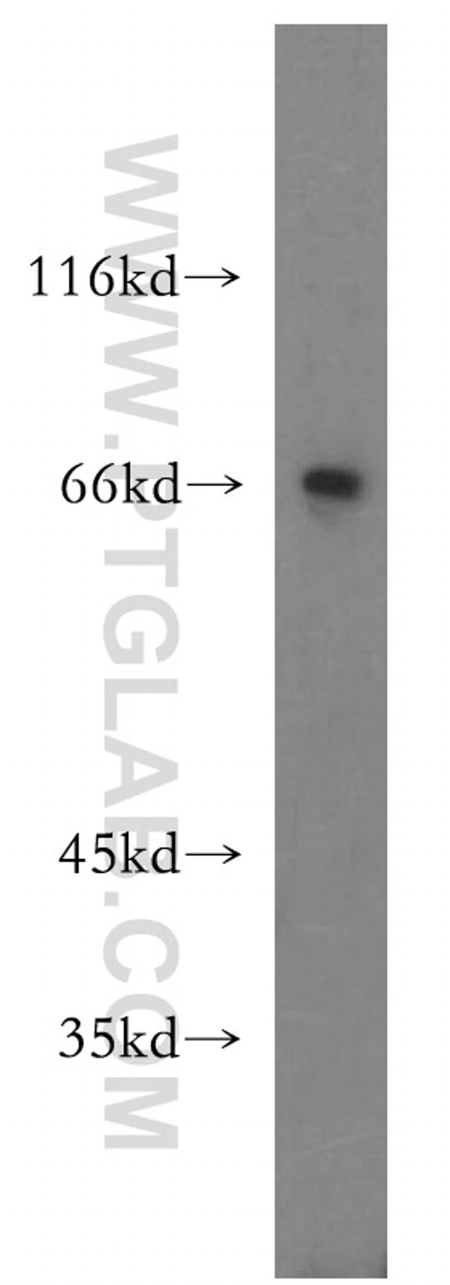 MTMR15 Antibody in Western Blot (WB)