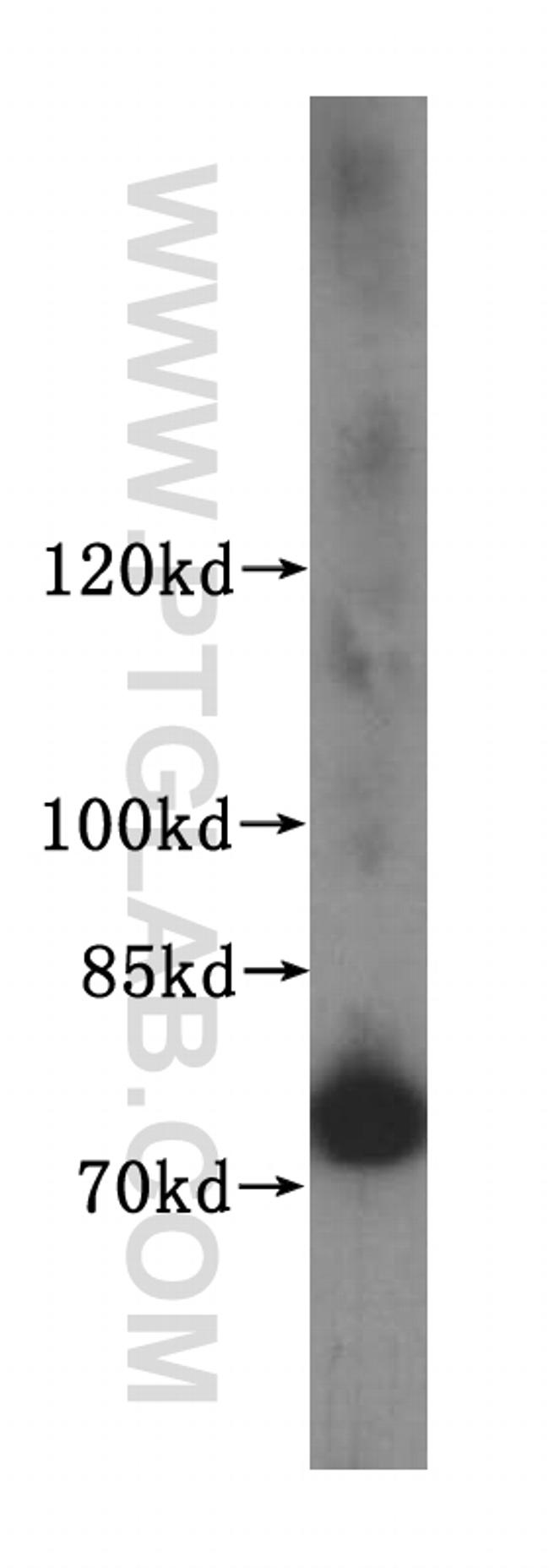 FIGNL1 Antibody in Western Blot (WB)