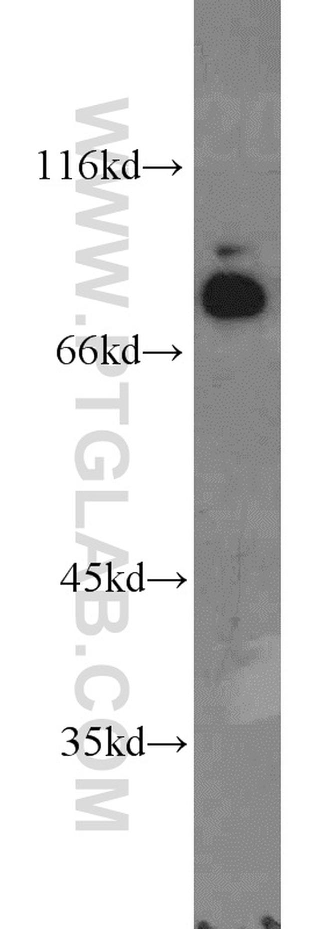 GTF3C4 Antibody in Western Blot (WB)