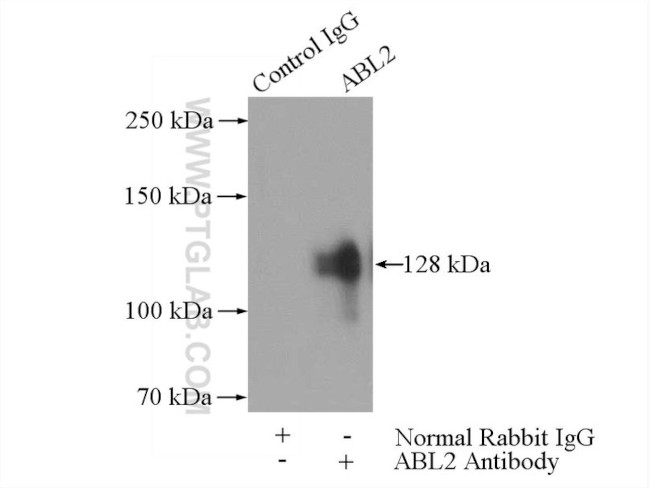 ABL2 Antibody in Immunoprecipitation (IP)