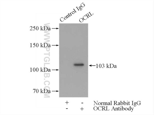 OCRL Antibody in Immunoprecipitation (IP)
