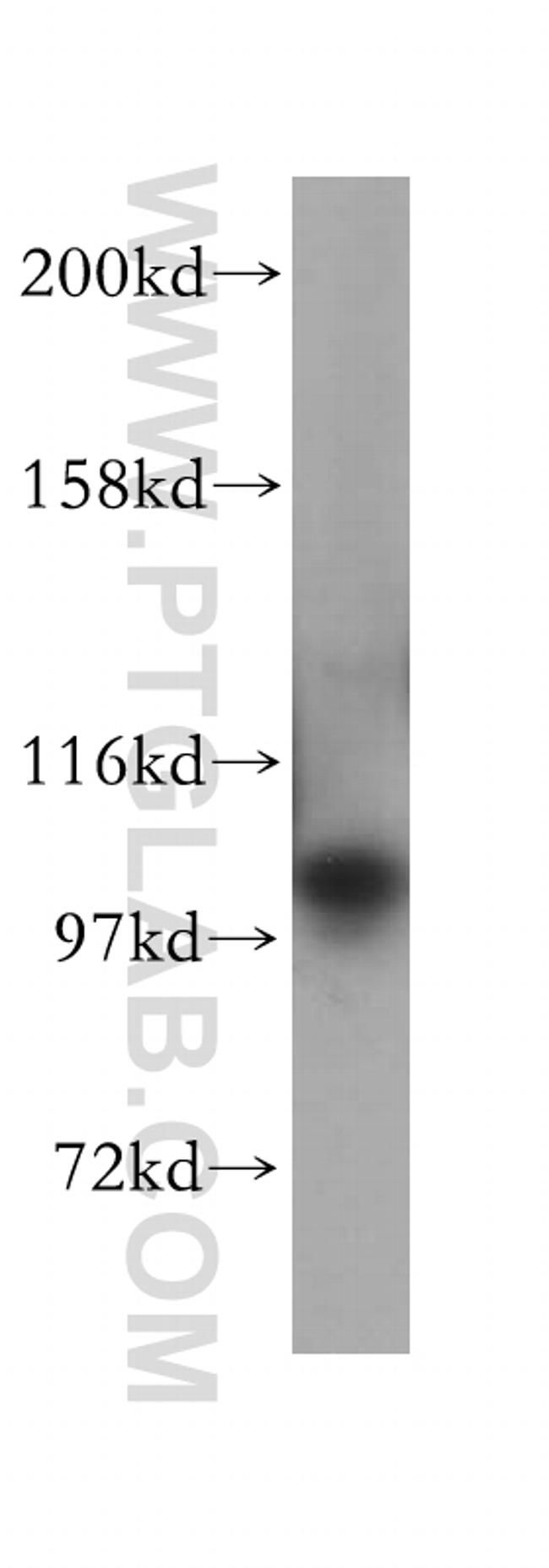 OCRL Antibody in Western Blot (WB)