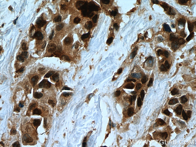 USP28 Antibody in Immunohistochemistry (Paraffin) (IHC (P))