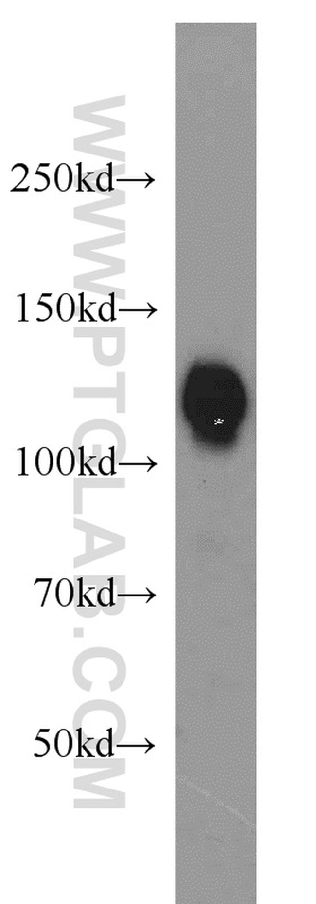 USP28 Antibody in Western Blot (WB)