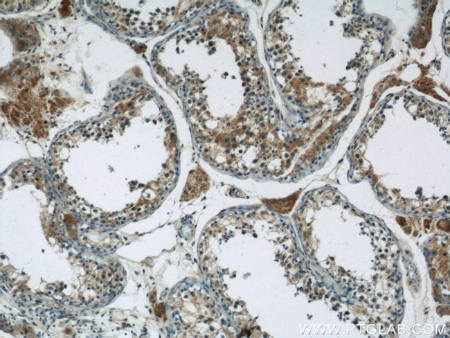 ARL13B Antibody in Immunohistochemistry (Paraffin) (IHC (P))