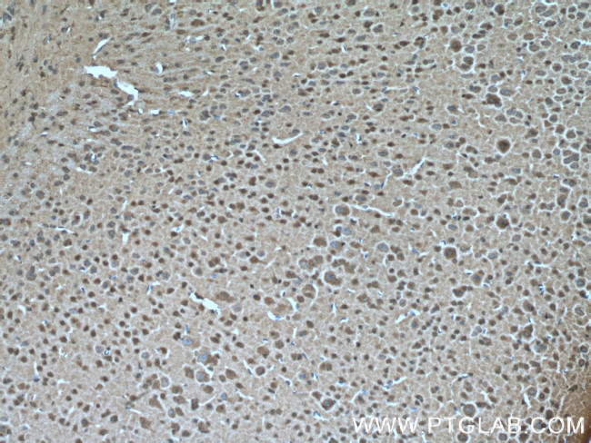 ARL13B Antibody in Immunohistochemistry (Paraffin) (IHC (P))