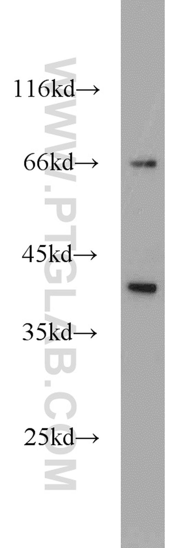 ARL13B Antibody in Western Blot (WB)