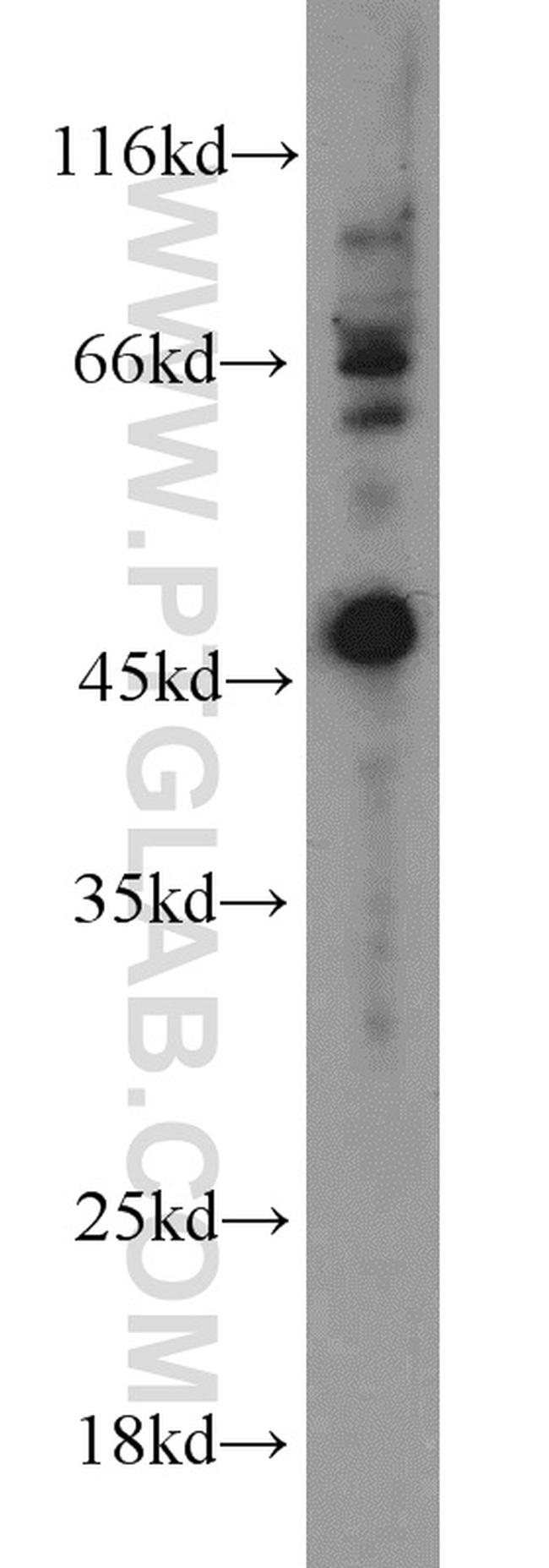 ARL13B Antibody in Western Blot (WB)