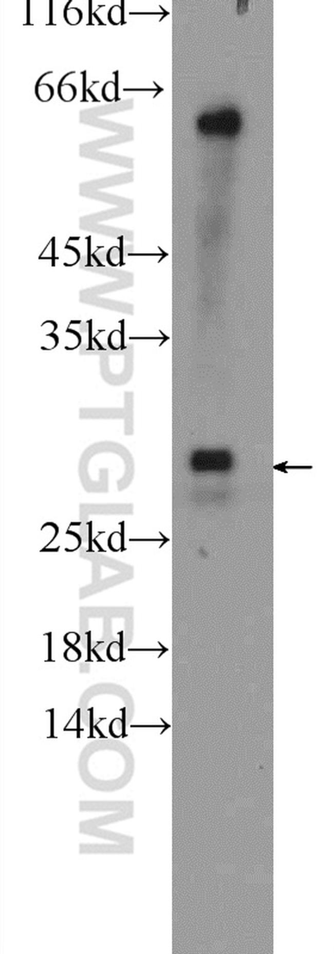 UBE2J2 Antibody in Western Blot (WB)