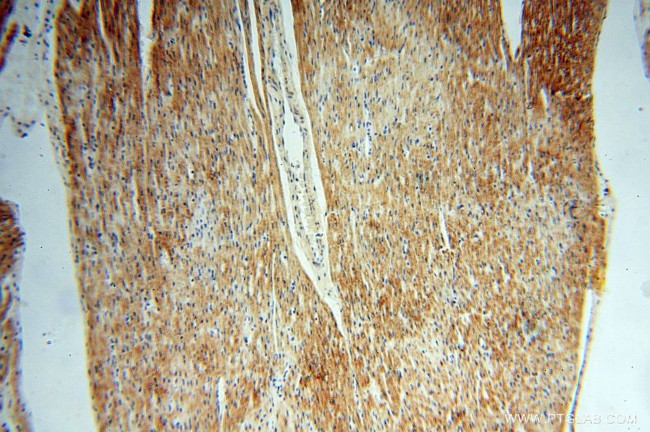 USMG5 Antibody in Immunohistochemistry (Paraffin) (IHC (P))