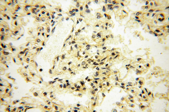 USMG5 Antibody in Immunohistochemistry (Paraffin) (IHC (P))