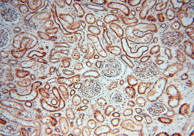 USMG5 Antibody in Immunohistochemistry (Paraffin) (IHC (P))