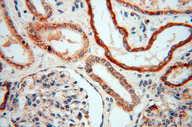 USMG5 Antibody in Immunohistochemistry (Paraffin) (IHC (P))