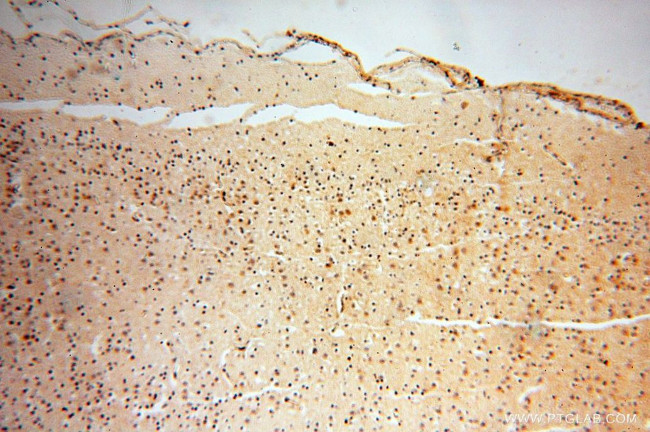 USMG5 Antibody in Immunohistochemistry (Paraffin) (IHC (P))