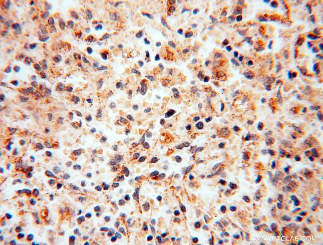 USMG5 Antibody in Immunohistochemistry (Paraffin) (IHC (P))