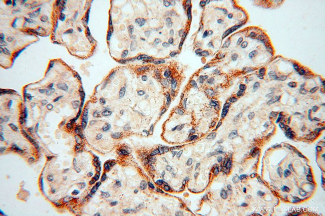 USMG5 Antibody in Immunohistochemistry (Paraffin) (IHC (P))