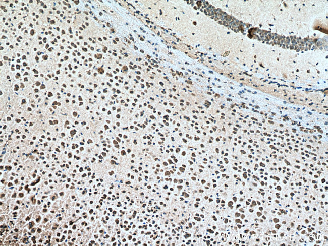 USMG5 Antibody in Immunohistochemistry (Paraffin) (IHC (P))