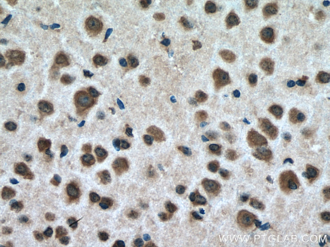 USMG5 Antibody in Immunohistochemistry (Paraffin) (IHC (P))