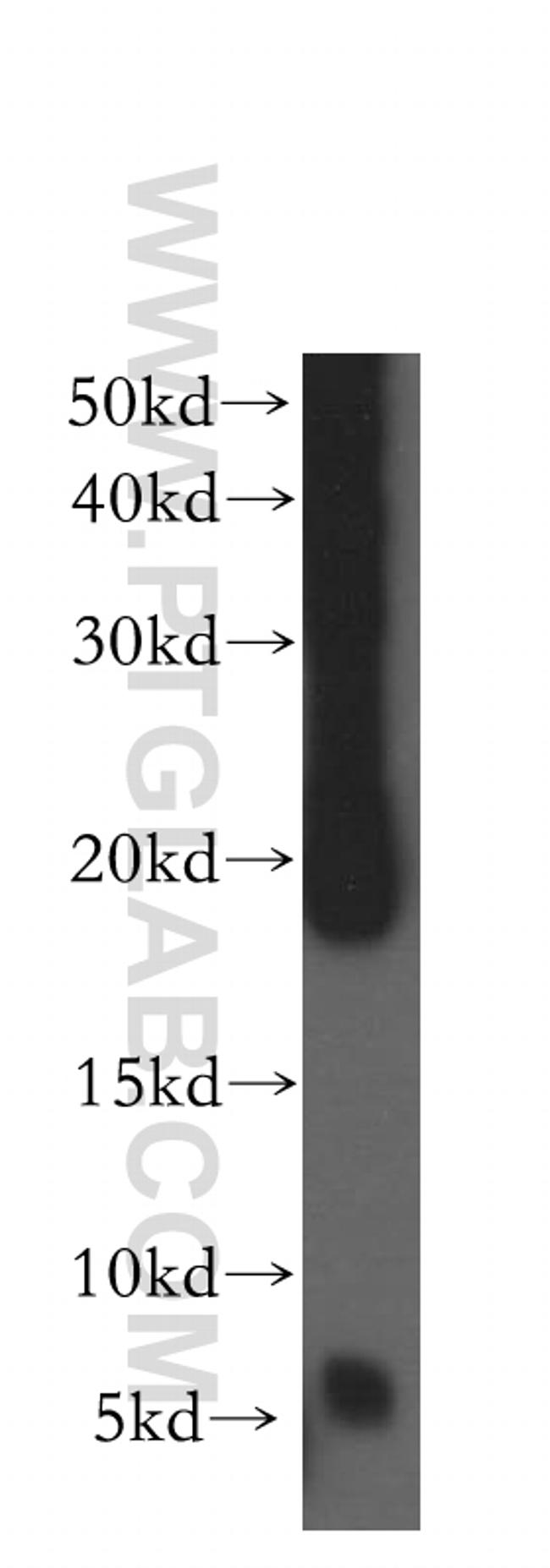 USMG5 Antibody in Western Blot (WB)