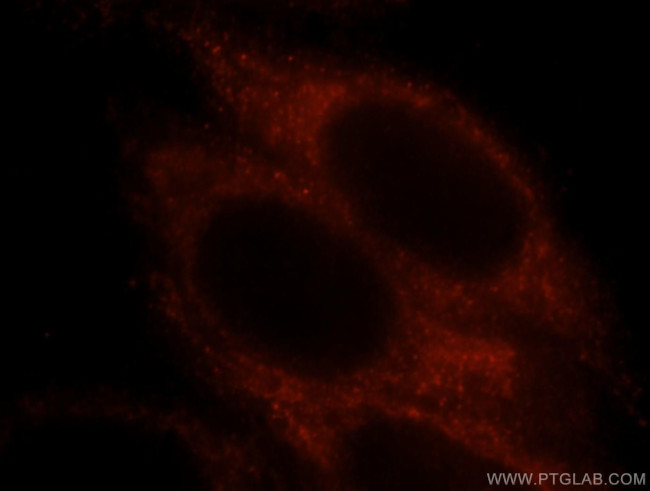 PRX5 Antibody in Immunocytochemistry (ICC/IF)