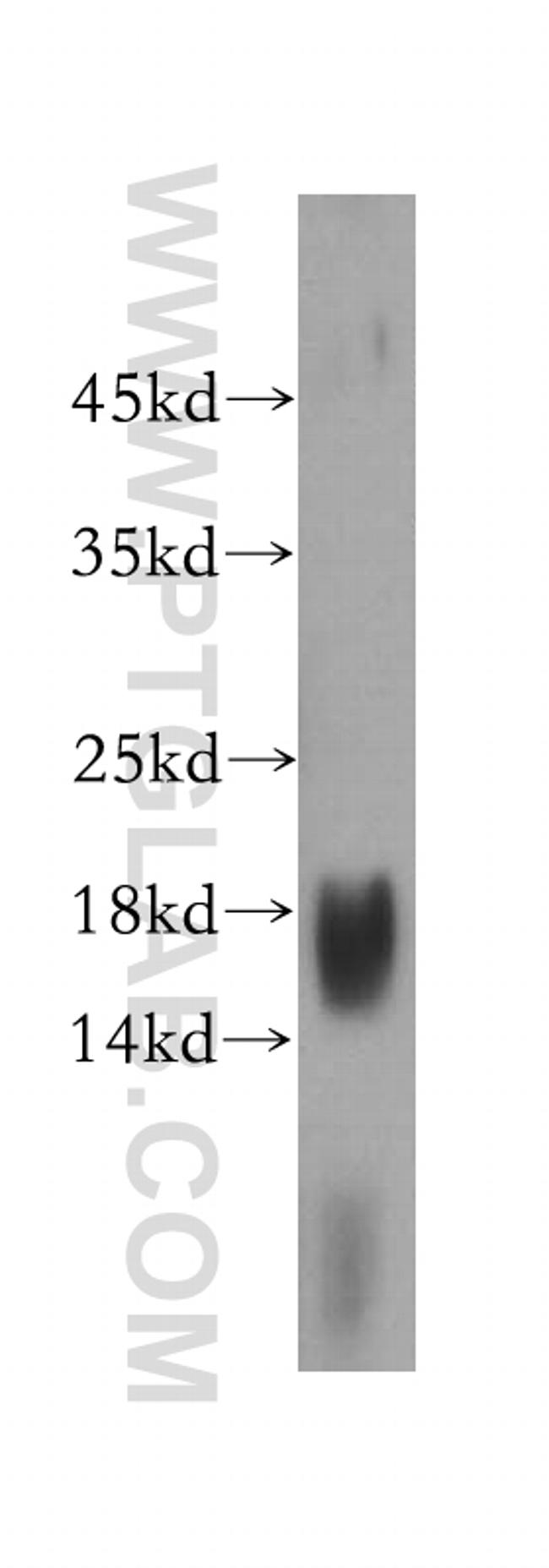PRX5 Antibody in Western Blot (WB)