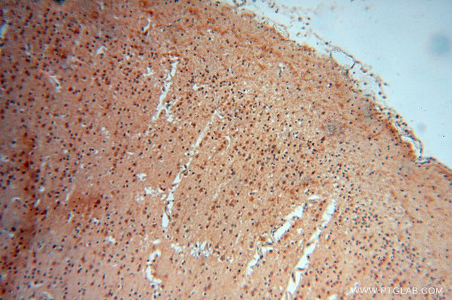 ATP6V1F Antibody in Immunohistochemistry (Paraffin) (IHC (P))